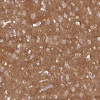 Immunohistochemical staining of human cerebral cortex shows strong cytoplasmic positivity in neuropil.