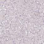 Immunohistochemical staining of human liver shows no positivity in hepatocytes as expected.