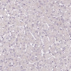 Immunohistochemical staining of human liver shows no positivity in hepatocytes as expected.