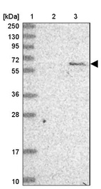 Lane 1: Marker [kDa] 250, 130, 95, 72, 55, 36, 28, 17, 10_br/_Lane 2: Human cell line RT-4_br/_Lane 3: Human cell line U-251 MG