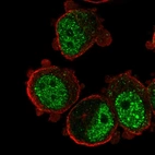 Immunofluorescent staining of human cell line PC-3 shows localization to nucleoplasm & nuclear bodies.