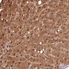 Anti-VN1R2 Antibody