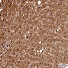 Anti-VN1R2 Antibody