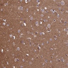 Anti-PCDHA5 Antibody