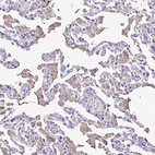 Immunohistochemical staining of human lung shows weak cytoplasmic positivity in macrophages.