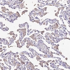 Immunohistochemical staining of human lung shows weak cytoplasmic positivity in macrophages.