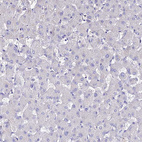 Immunohistochemical staining of human liver shows no positivity in hepatocytes as expected.