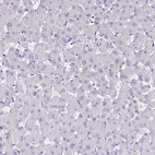 Immunohistochemical staining of human liver shows no positivity in hepatocytes as expected.