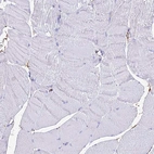 Immunohistochemical staining of human skeletal muscle shows no positivity in myocytes as expected.