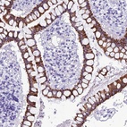 Anti-TRAM1L1 Antibody