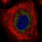Immunofluorescent staining of human cell line A-431 shows localization to mitochondria.