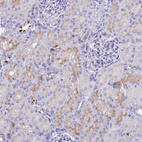 Anti-TMEM161B Antibody