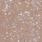 Anti-TMEM161B Antibody