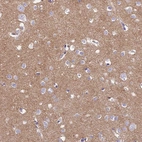 Immunohistochemical staining of human cerebral cortex shows moderate cytoplasmic positivity in neuropil.