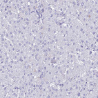 Anti-TMEM161B Antibody