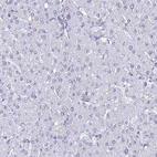 Immunohistochemical staining of human liver shows no positivity in hepatocytes as expected.