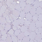 Immunohistochemical staining of human skeletal muscle shows no positivity in myocytes as expected.