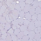 Immunohistochemical staining of human skeletal muscle shows no positivity in myocytes as expected.