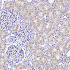 Anti-SMR3A Antibody