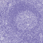 Immunohistochemical staining of human tonsil shows no cytoplasmic positivity in non-germinal center cells as expected.