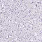 Anti-SMR3A Antibody