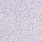Immunohistochemical staining of human liver shows no cytoplasmic positivity in hepatocytes as expected.