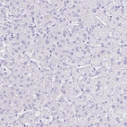Immunohistochemical staining of human liver shows no cytoplasmic positivity in hepatocytes as expected.