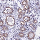 Anti-RASGEF1B Antibody