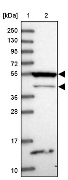 Lane 1: Marker [kDa] 250, 130, 95, 72, 55, 36, 28, 17, 10_br/_Lane 2: Human cell line RT-4