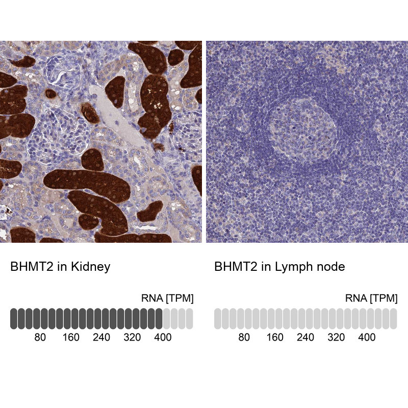 Anti-BHMT2 Antibody