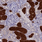 Immunohistochemical staining of human kidney shows high expression.