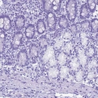 Immunohistochemical staining of human duodenum shows no positivity in glandular cells as expected.