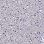 Immunohistochemical staining of human cerebral cortex shows moderate positivity in neuronal processes.