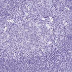 Immunohistochemical staining of human tonsil shows no positivity in germinal center cells as expected.
