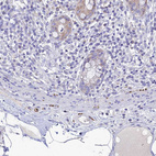Immunohistochemical staining of human rectum shows moderate positivity in peripheral nerve / ganglion.