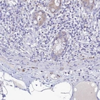 Immunohistochemical staining of human rectum shows moderate positivity in peripheral nerve / ganglion.