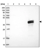 Lane 1: Marker [kDa] 250, 130, 95, 72, 55, 36, 28, 17, 10_br/_Lane 2: Human cell line RT-4_br/_Lane 3: Human cell line U-251MG sp_br/_Lane 4: Human plasma (IgG/HSA depleted)_br/_Lane 5: Human liver tissue_br/_Lane 6: Human tonsil tissue