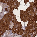 Immunohistochemical staining of human salivary gland shows strong cytoplasmic positivity in glandular cells.