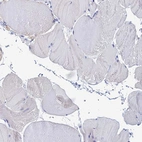 Immunohistochemical staining of human skeletal muscle shows no positivity in myocytes as expected.