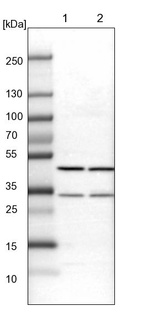 Lane 1: Mouse liver tissue lysate_br/_Lane 2: Rat liver tissue lysate