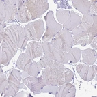 Immunohistochemical staining of human skeletal muscle shows no positivity in myocytes as expected.