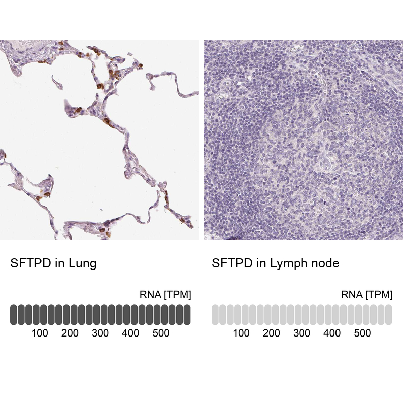 Anti-SFTPD Antibody