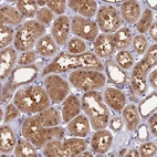 Immunohistochemical staining of human kidney shows moderate cytoplasmic positivity in cells in tubules.