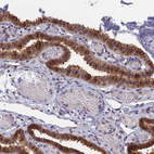 Immunohistochemical staining of human fallopian tube shows moderate cytoplasmic positivity in glandular cells.