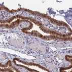 Immunohistochemical staining of human fallopian tube shows moderate cytoplasmic positivity in glandular cells.