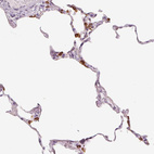 Immunohistochemical staining of human lung shows strong granular cytoplasmic positivity in pneumocytes.
