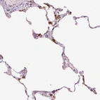 Immunohistochemical staining of human lung shows strong granular cytoplasmic positivity in pneumocytes.