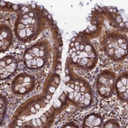 Immunohistochemical staining of human gastrointestinal shows cytoplasmic positivity in glandular cells.