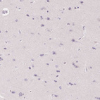 Immunohistochemical staining of human cerebral cortex shows no positivity in neurons as expected.