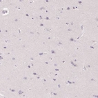 Immunohistochemical staining of human cerebral cortex shows no positivity in neurons as expected.
